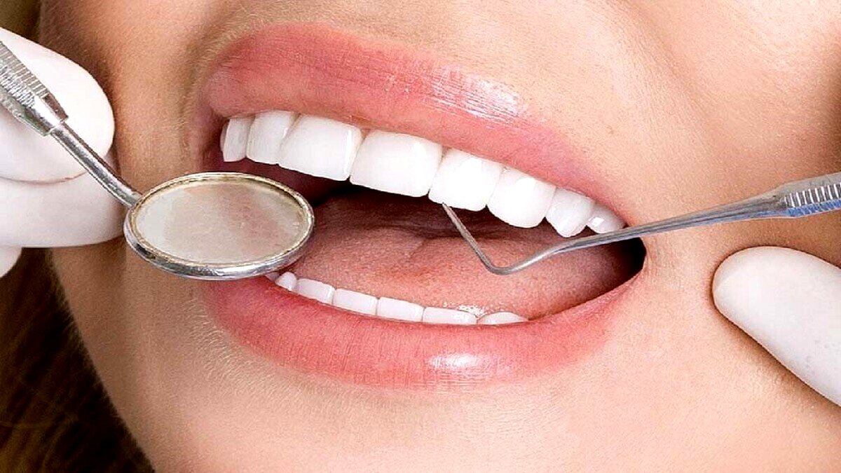 هزینه ایمپلنت دندان با بیمه چقدر است؟